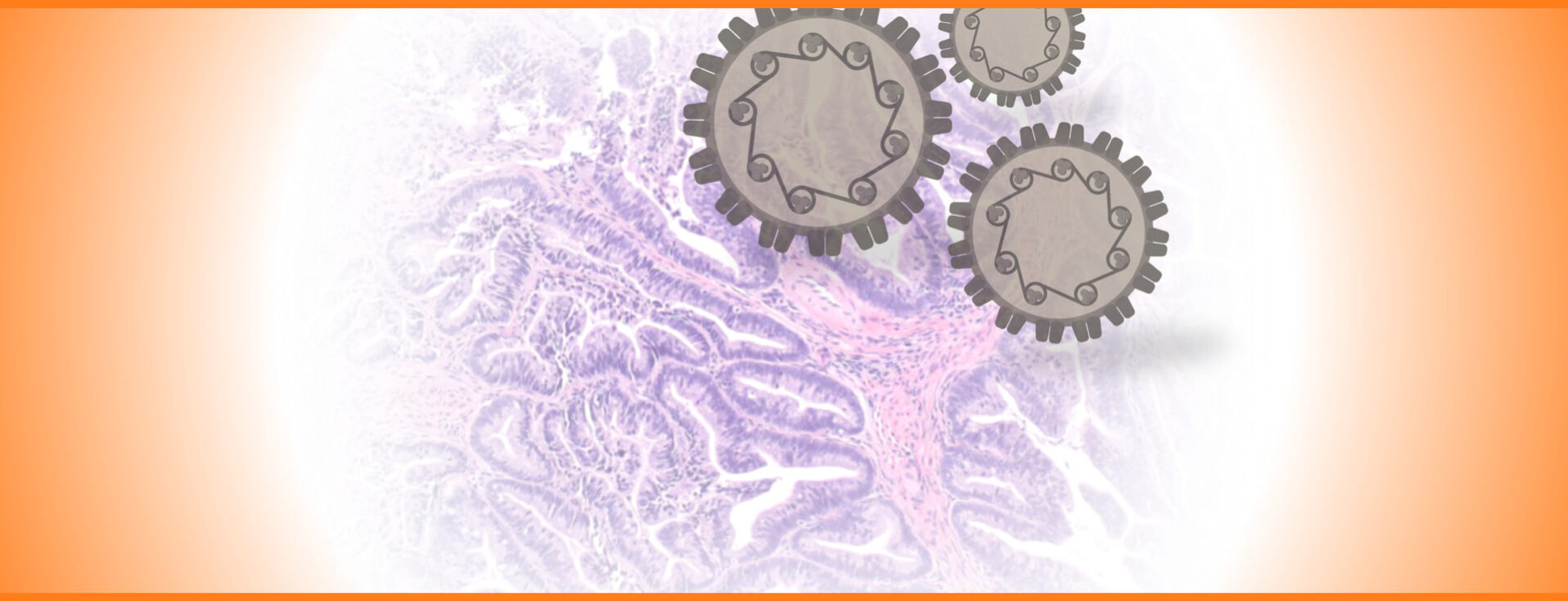 Adenocarcinoma in situ do colo uterino (AIS): Guia prático de conduta